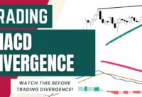 MACD DIVERGENCE TRADING STRATEGY (A Must Watch)