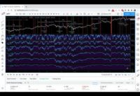 Tradingview Strategy Algorithmic Trading – Perfect Momentum Strategy – How To Use The Stochastics